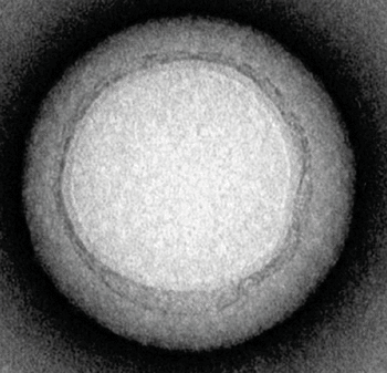 Imagen: B: Una imagen TEM (microscopía electrónica de transmisión) de una nanoesponja demostró que las nanoesponjas tienen un diámetro de aproximadamente 85 nanómetros (Fotografía cortesía del Laboratorio de Investigación Zhang, Facultad de Ingeniería Jacobs de la Universidad de California, San Diego).